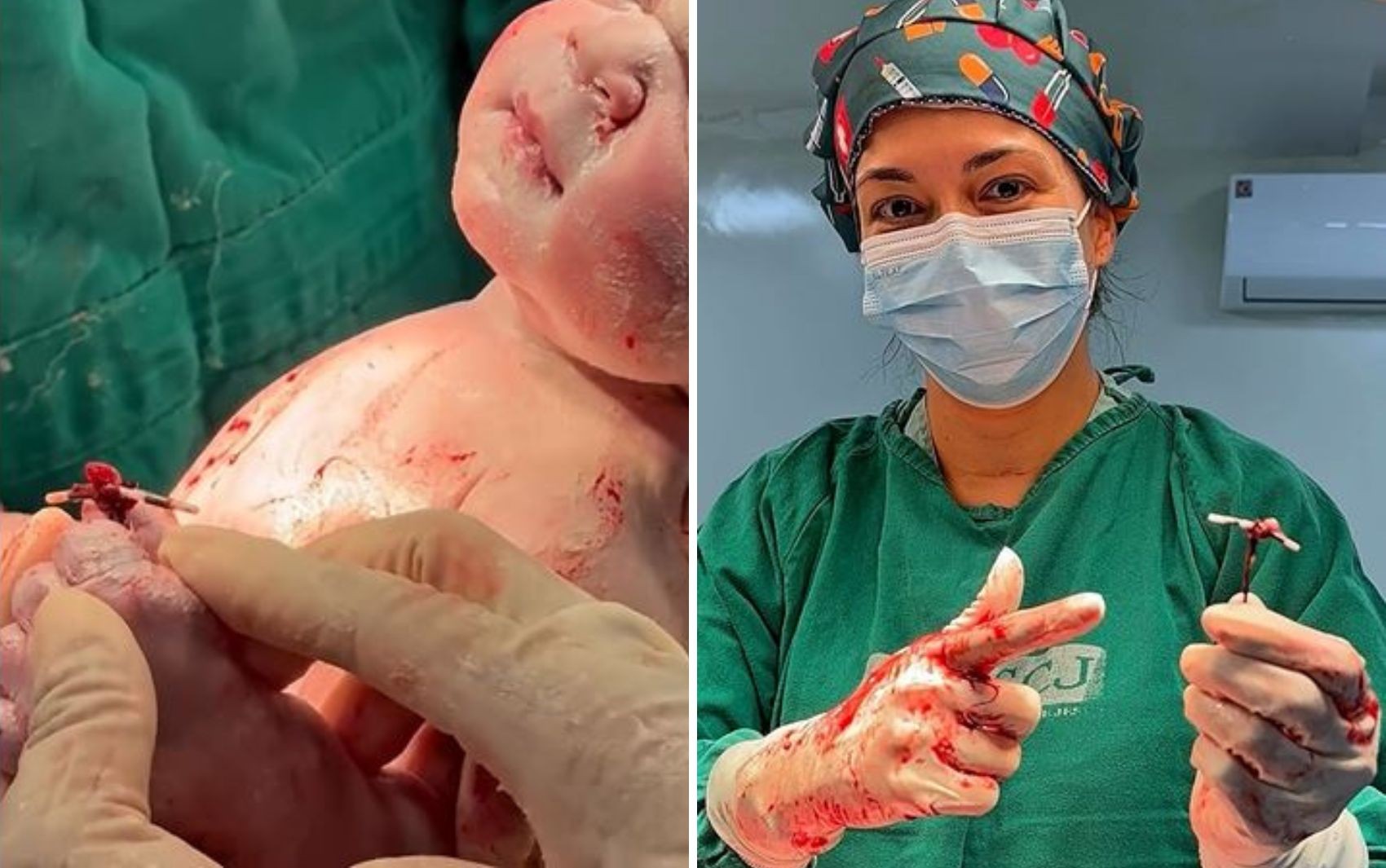 foto Not&iacute;cia Goiânia